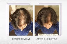 Load image into Gallery viewer, Zenagen Revolve Hair Loss Shampoo Treatment for Women