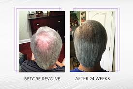 Zenagen Revolve Hair Loss Shampoo Treatment for Men